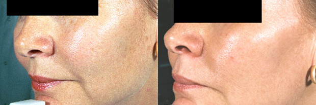 Clinica Betancourt, Pozuelo, Madrid