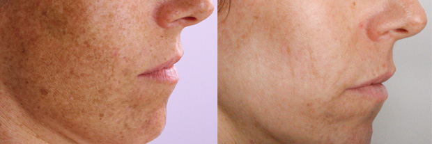 Clinica Betancourt, Pozuelo, Madrid