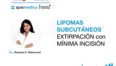 lipomas subcutáneos láser fotona