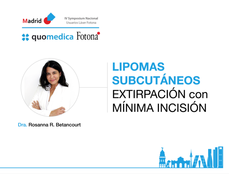 lipomas subcutáneos láser fotona