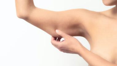 endolifting brazos