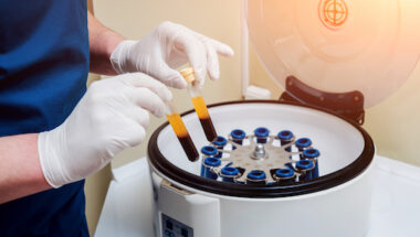 prp facial