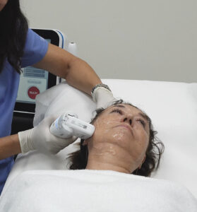 Tratamiento Liftera HIFU con ultrasonido microfocalizado en clínica de Madrid