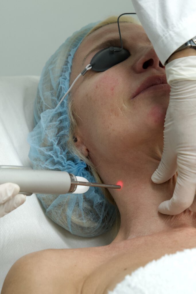 Fotona 4D para rejuvenecimiento facial seguro en verano
